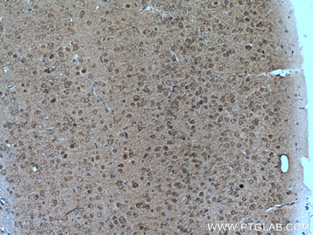 Immunohistochemistry (IHC) staining of mouse brain tissue using GABARAPL1 Polyclonal antibody (11010-1-AP)