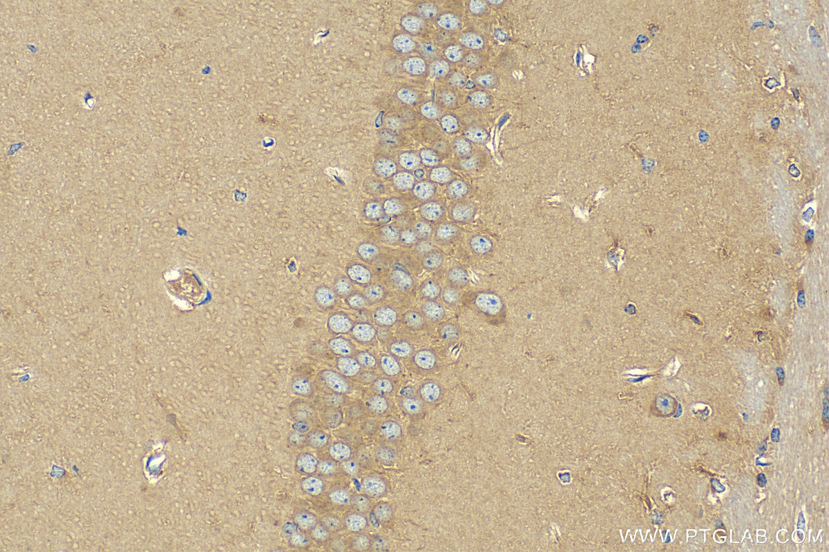 Immunohistochemistry (IHC) staining of mouse brain tissue using GABARAPL1 Polyclonal antibody (11010-1-AP)