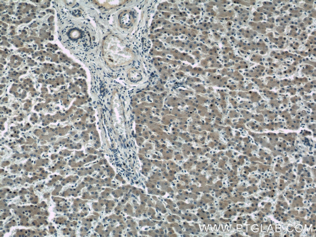 Immunohistochemistry (IHC) staining of human liver tissue using GABARAPL1 Polyclonal antibody (11010-1-AP)