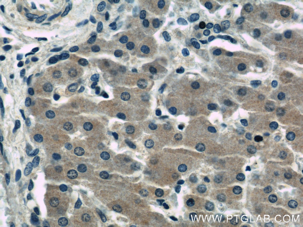 IHC staining of human liver using 11010-1-AP