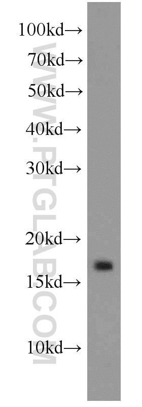 Western Blot (WB) analysis of rat brain tissue using GABARAPL1 Polyclonal antibody (11010-1-AP)