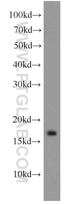 WB analysis of rat brain using 11010-1-AP