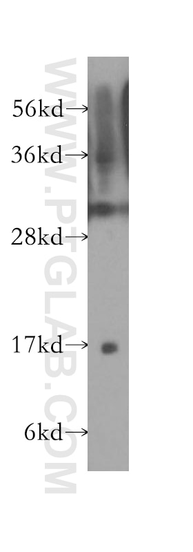 Western Blot (WB) analysis of HepG2 cells using GABARAPL1 Polyclonal antibody (11010-1-AP)