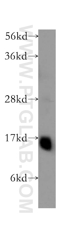 Western Blot (WB) analysis of human heart tissue using GABARAPL1 Polyclonal antibody (11010-1-AP)