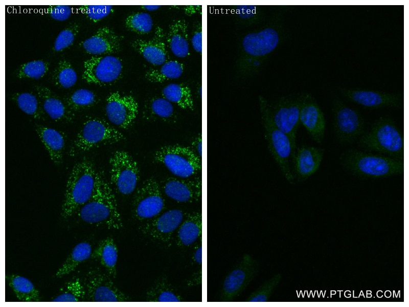 Immunofluorescence (IF) / fluorescent staining of HepG2 cells using GABARAPL1 Recombinant antibody (83817-1-RR)