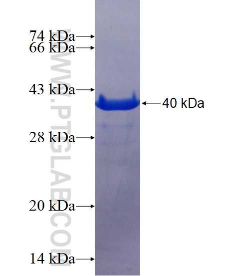 ATG8L fusion protein Ag1473 SDS-PAGE
