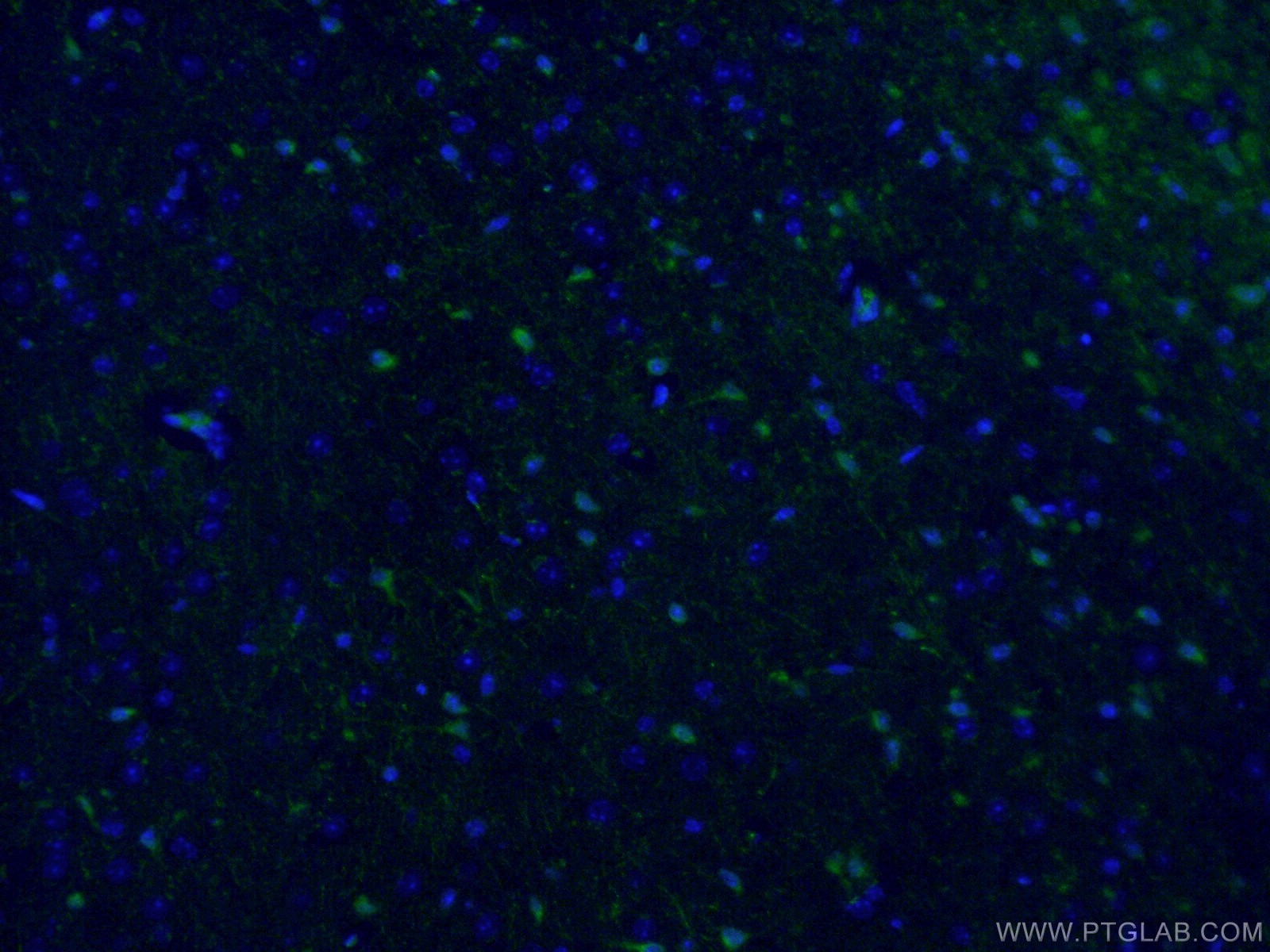 IF Staining of mouse brain using 26276-1-AP