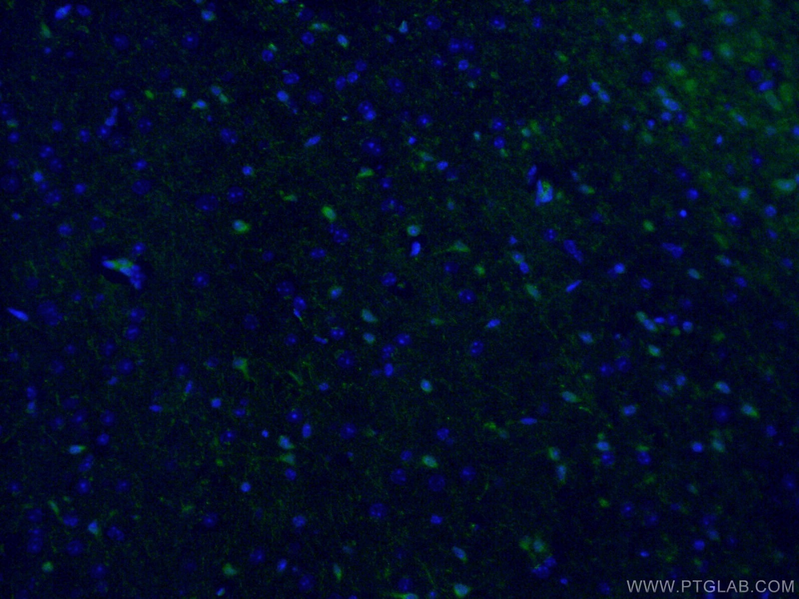 Immunofluorescence (IF) / fluorescent staining of mouse brain tissue using ATG9A Polyclonal antibody (26276-1-AP)