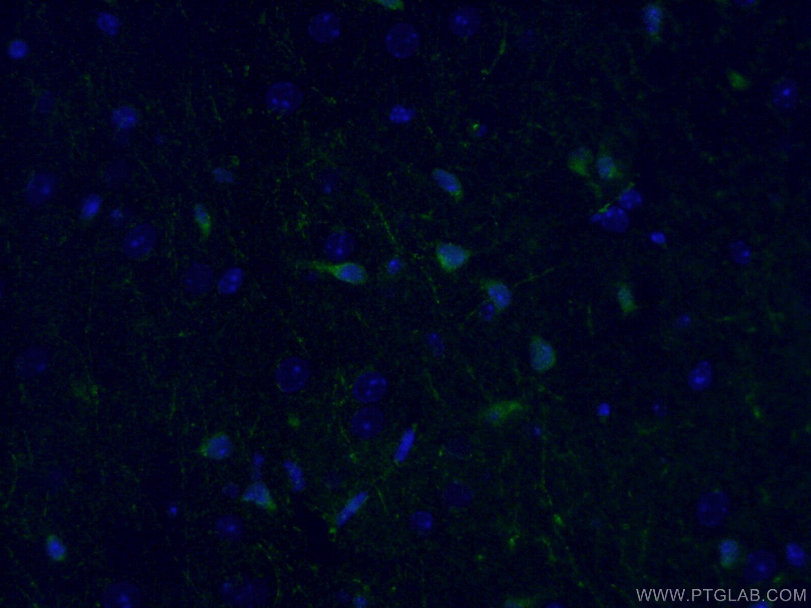 Immunofluorescence (IF) / fluorescent staining of mouse brain tissue using ATG9A Polyclonal antibody (26276-1-AP)