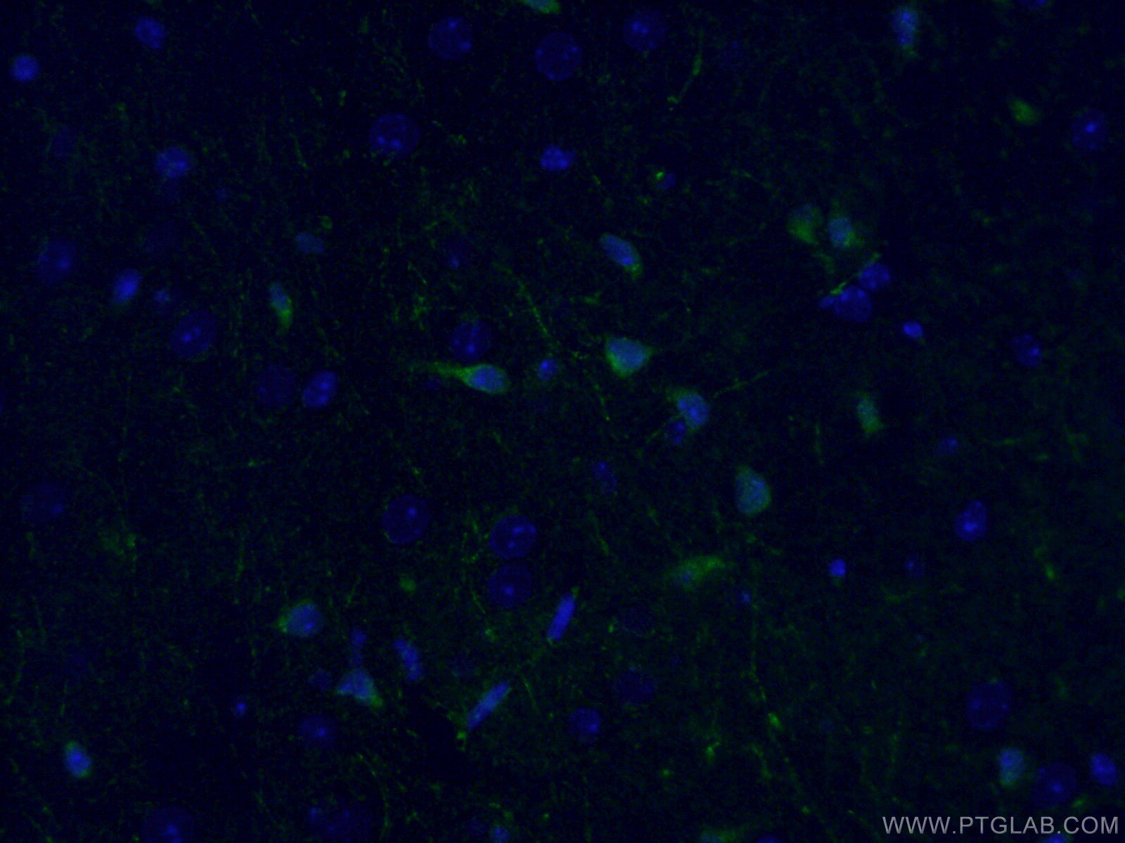 IF Staining of mouse brain using 26276-1-AP