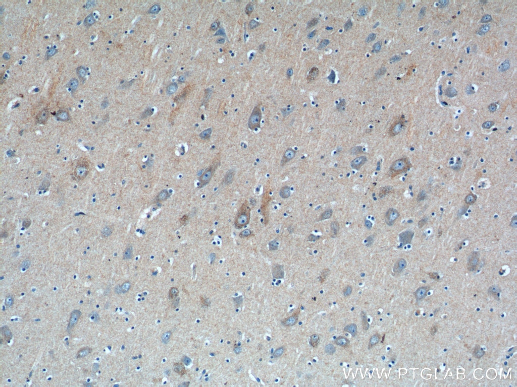 Immunohistochemistry (IHC) staining of human brain tissue using ATG9A Polyclonal antibody (26276-1-AP)