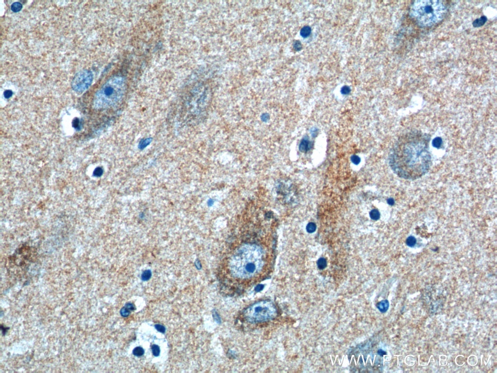 Immunohistochemistry (IHC) staining of human brain tissue using ATG9A Polyclonal antibody (26276-1-AP)