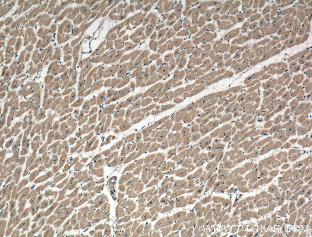 Immunohistochemistry (IHC) staining of human heart tissue using ATG9A Polyclonal antibody (26276-1-AP)