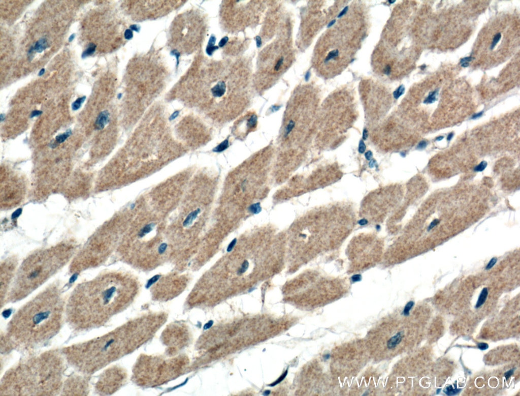 Immunohistochemistry (IHC) staining of human heart tissue using ATG9A Polyclonal antibody (26276-1-AP)