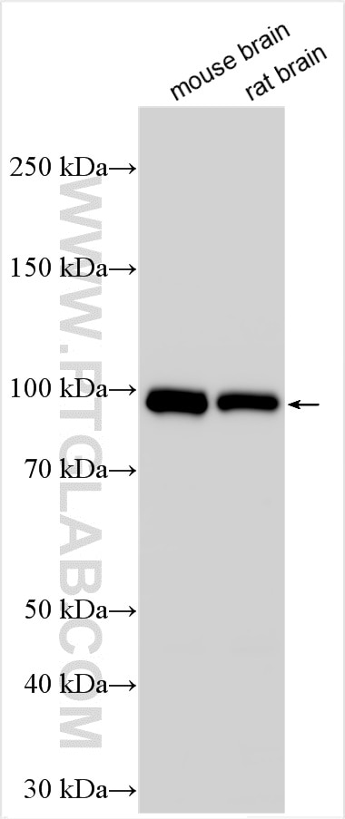 Western Blot (WB) analysis of various lysates using ATG9A Polyclonal antibody (26276-1-AP)