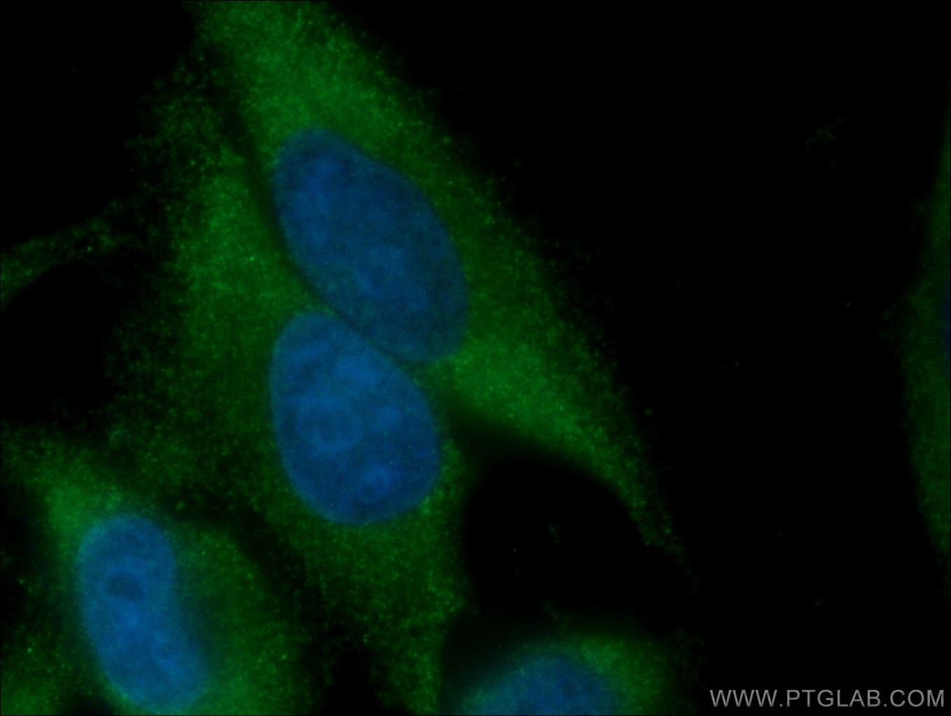 Immunofluorescence (IF) / fluorescent staining of HepG2 cells using ATG9A Monoclonal antibody (67096-1-Ig)