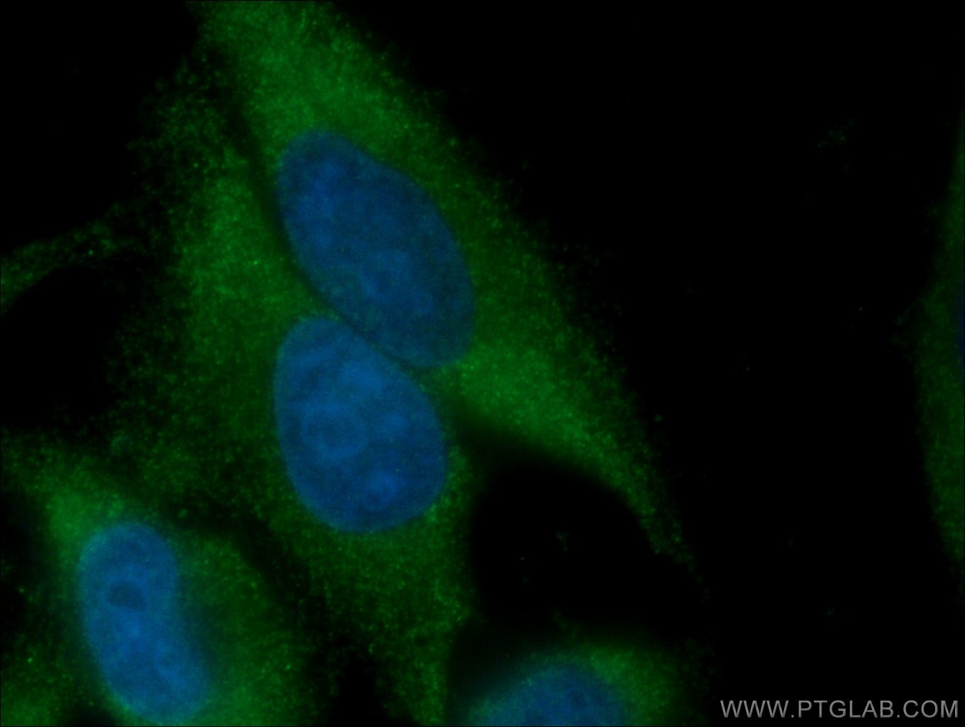 IF Staining of HepG2 using 67096-1-Ig