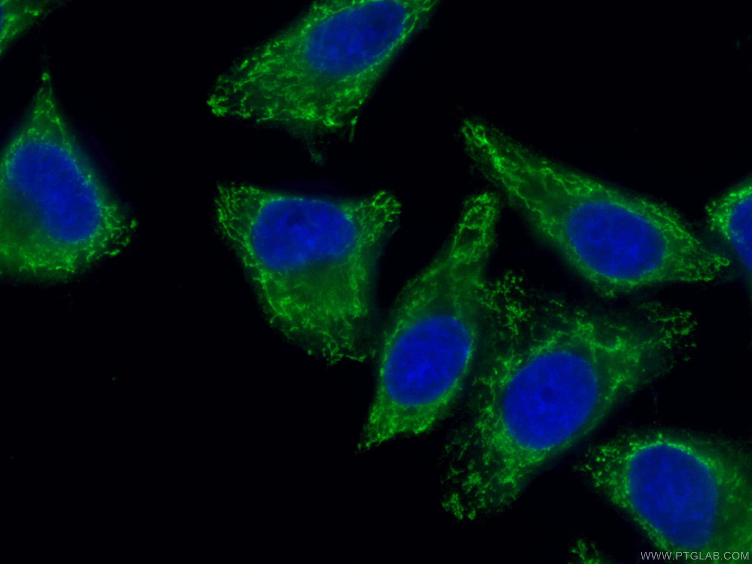 Immunofluorescence (IF) / fluorescent staining of HepG2 cells using CoraLite® Plus 488-conjugated ATG9A Monoclonal ant (CL488-67096)