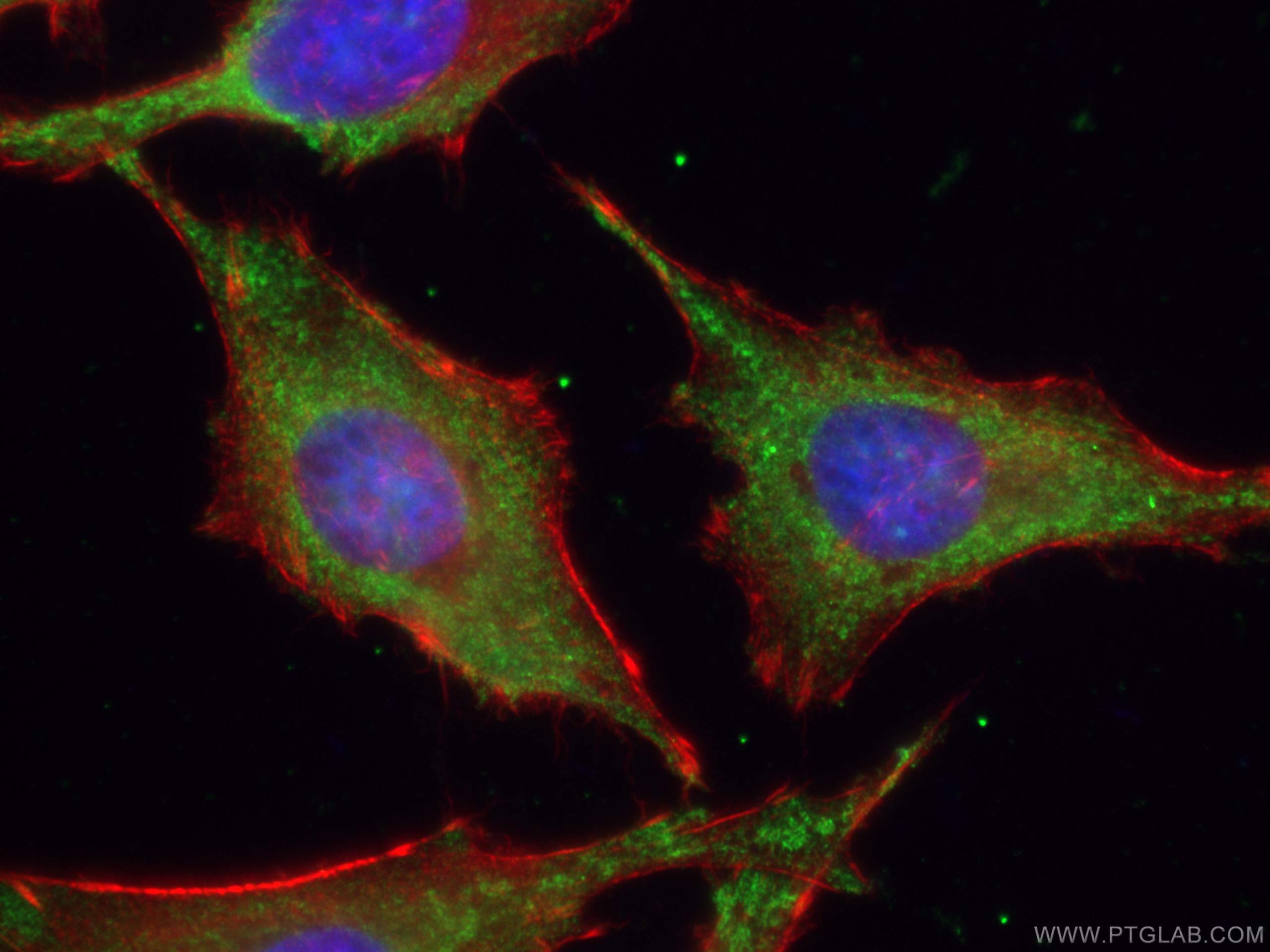 Immunofluorescence (IF) / fluorescent staining of HeLa cells using CoraLite® Plus 488-conjugated ATG9A Monoclonal ant (CL488-67096)