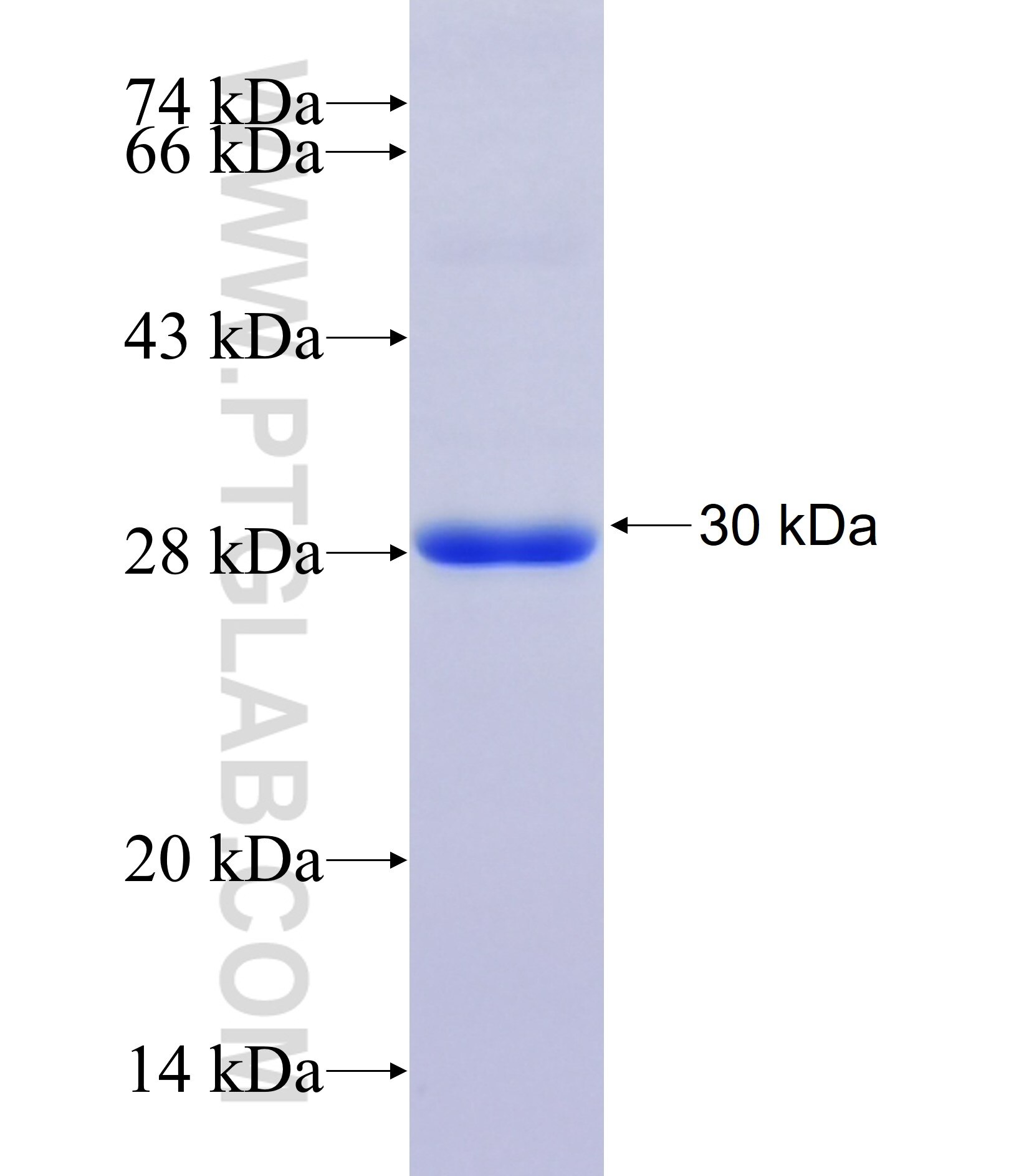 ATG9B fusion protein Ag37165 SDS-PAGE ATG9B fusion protein Ag37165 SDS-PAGE