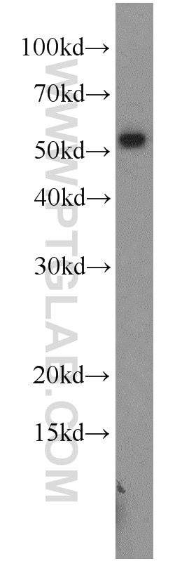 WB analysis of mouse testis using 55190-1-AP