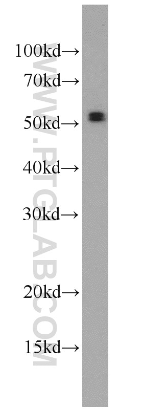 WB analysis of 3T3-L1 using 55190-1-AP