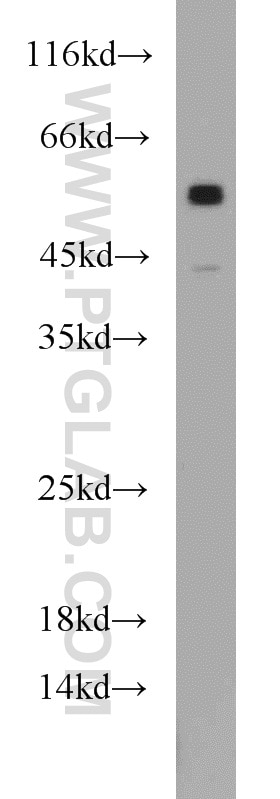 Western Blot (WB) analysis of A431 cells using ATGL Polyclonal antibody (55190-1-AP)