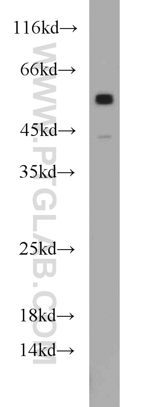 WB analysis of A431 using 55190-1-AP