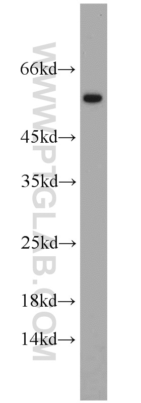 Western Blot (WB) analysis of human heart tissue using ATGL Polyclonal antibody (55190-1-AP)