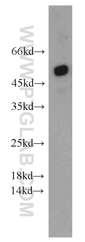 Western Blot (WB) analysis of HeLa cells using ATGL Polyclonal antibody (55190-1-AP)