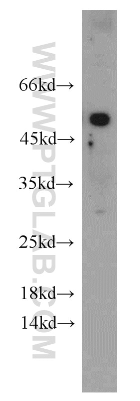 Western Blot (WB) analysis of HeLa cells using ATGL Polyclonal antibody (55190-1-AP)