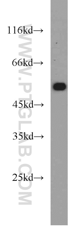 Western Blot (WB) analysis of rat heart tissue using ATGL Polyclonal antibody (55190-1-AP)