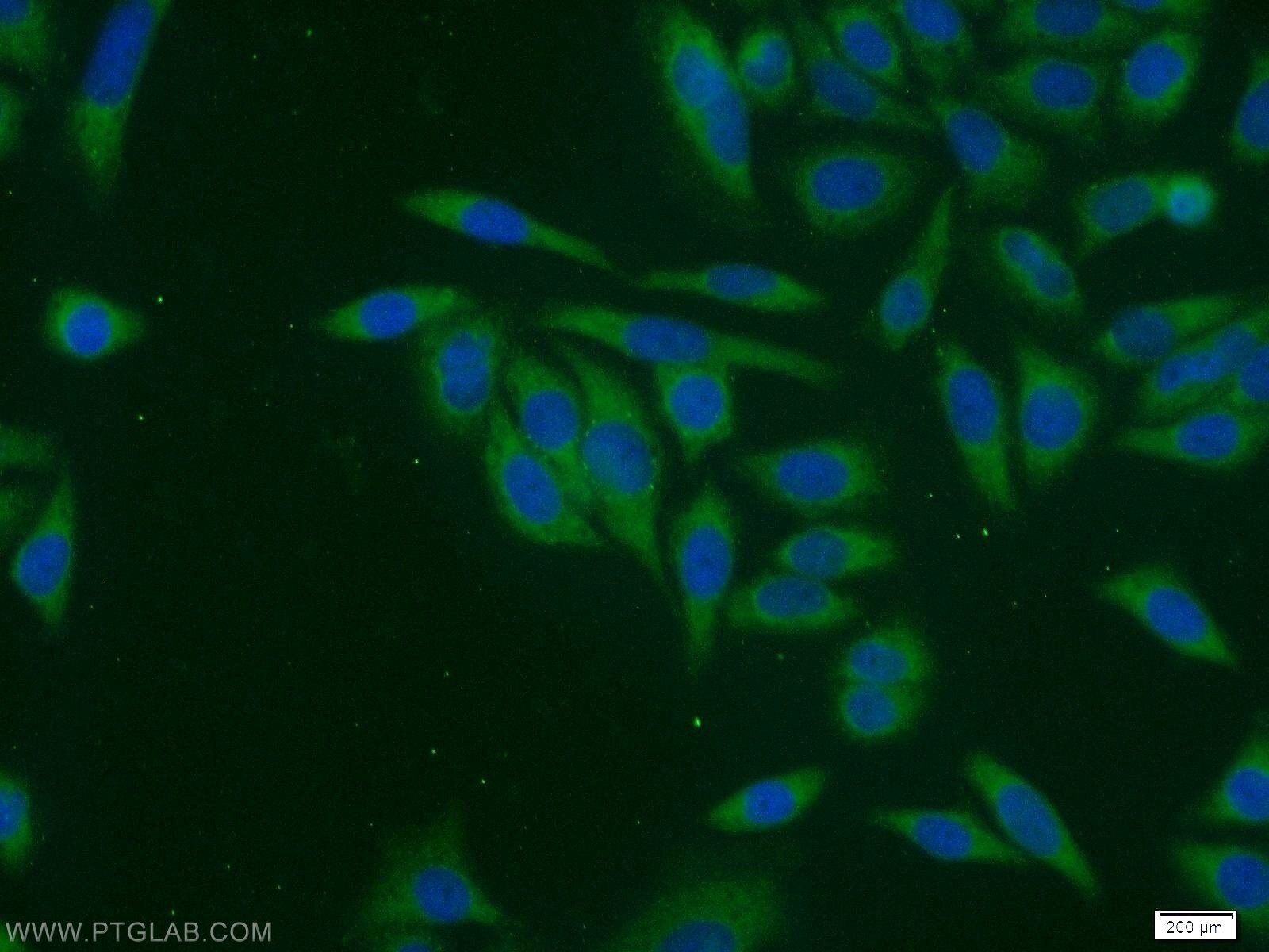 Immunofluorescence (IF) / fluorescent staining of HeLa cells using ATIC Polyclonal antibody (10726-1-AP)