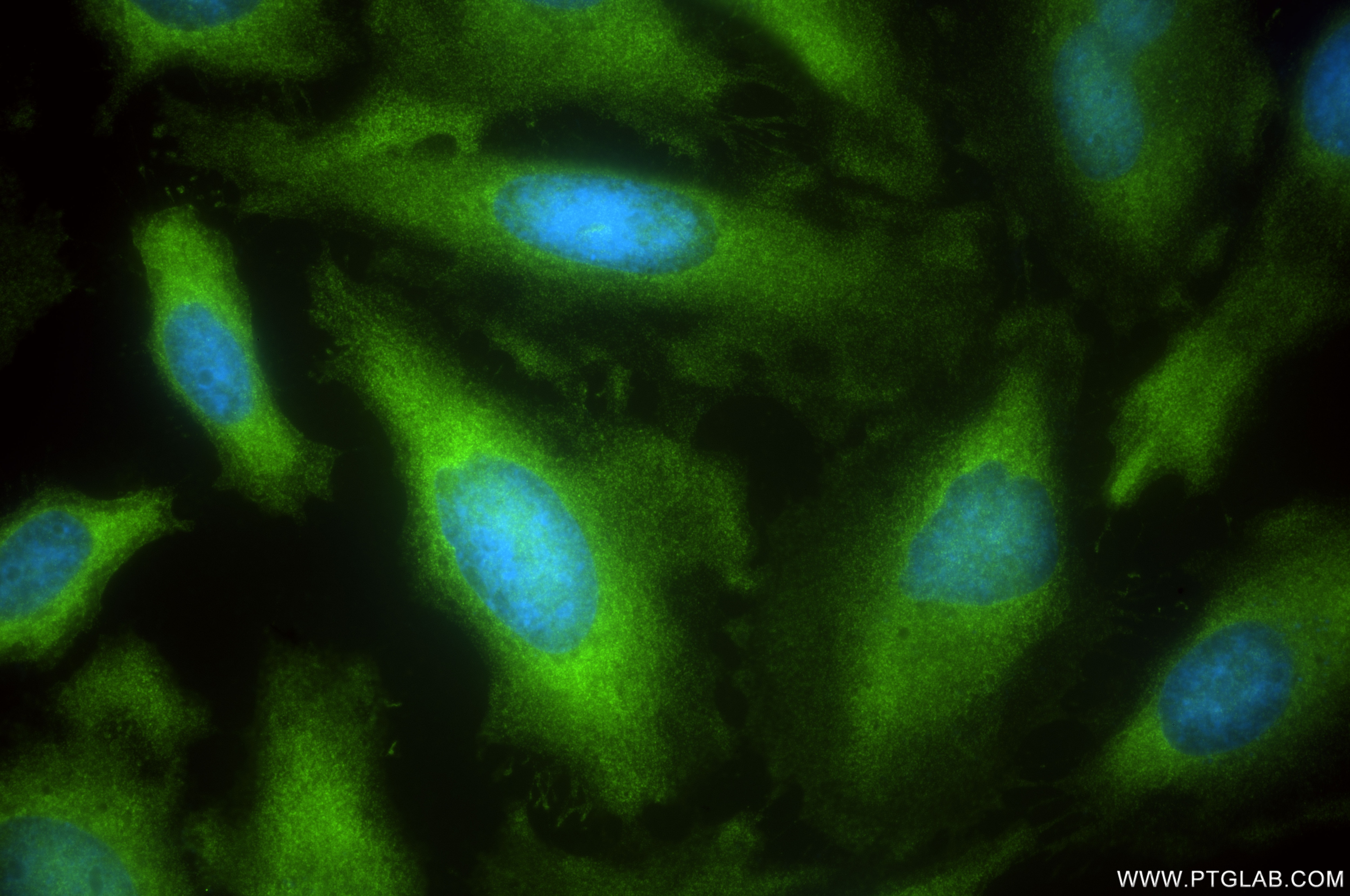 Immunofluorescence (IF) / fluorescent staining of HeLa cells using ATIC Recombinant antibody (84798-5-RR)