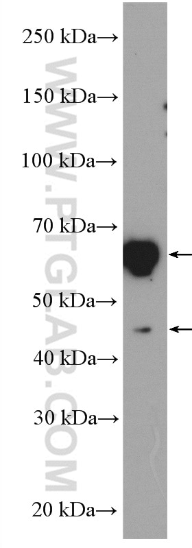 Western Blot (WB) analysis of Jurkat cells using ATL2 Polyclonal antibody (16688-1-AP)