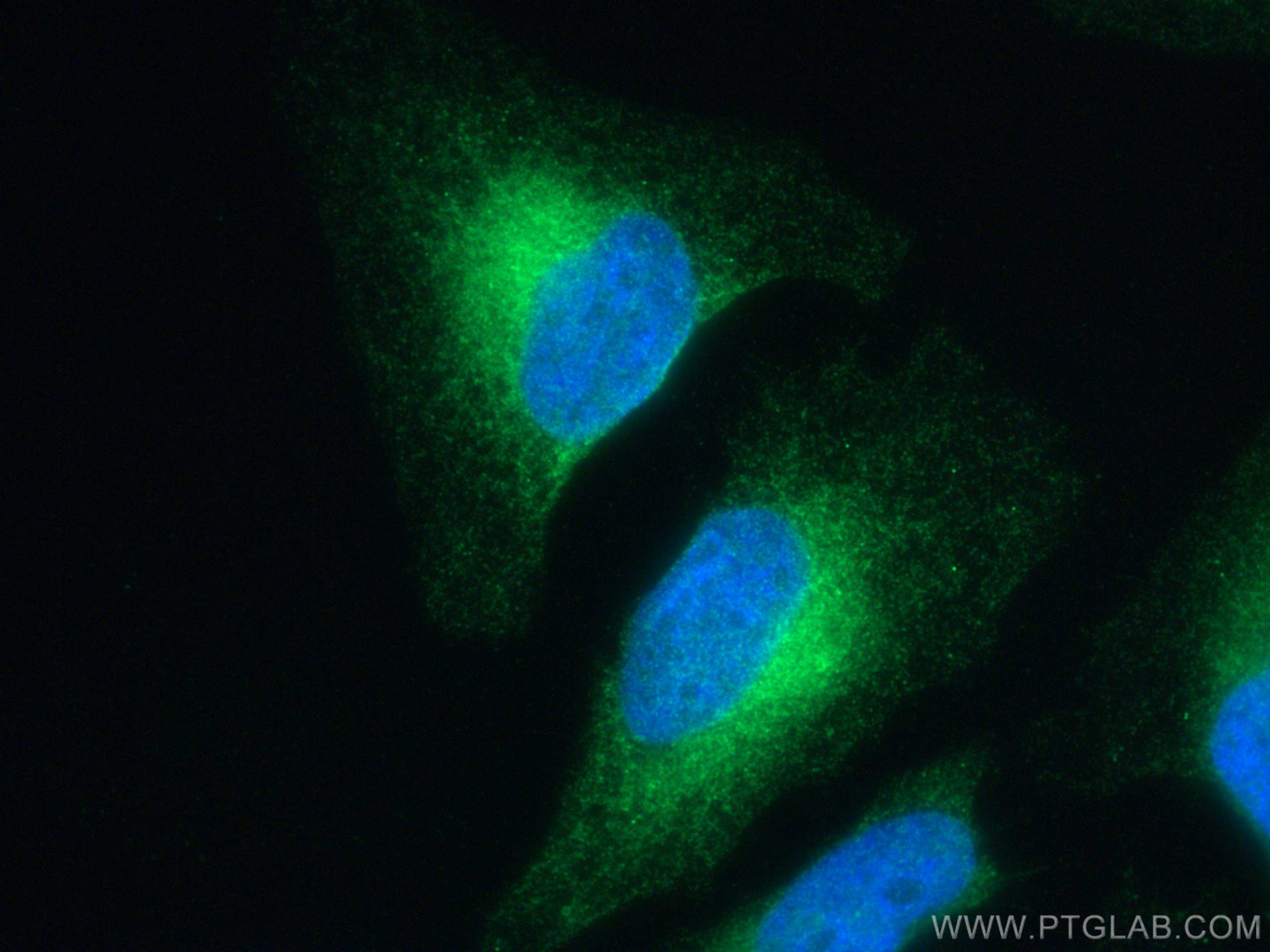 Immunofluorescence (IF) / fluorescent staining of HeLa cells using ATL3 Polyclonal antibody (16921-1-AP)