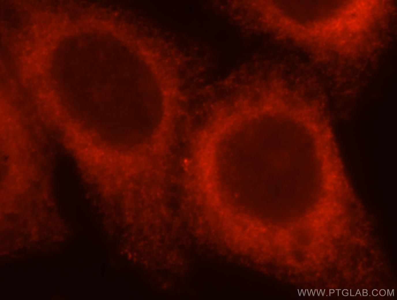 Immunofluorescence (IF) / fluorescent staining of HepG2 cells using ATL3 Polyclonal antibody (16921-1-AP)
