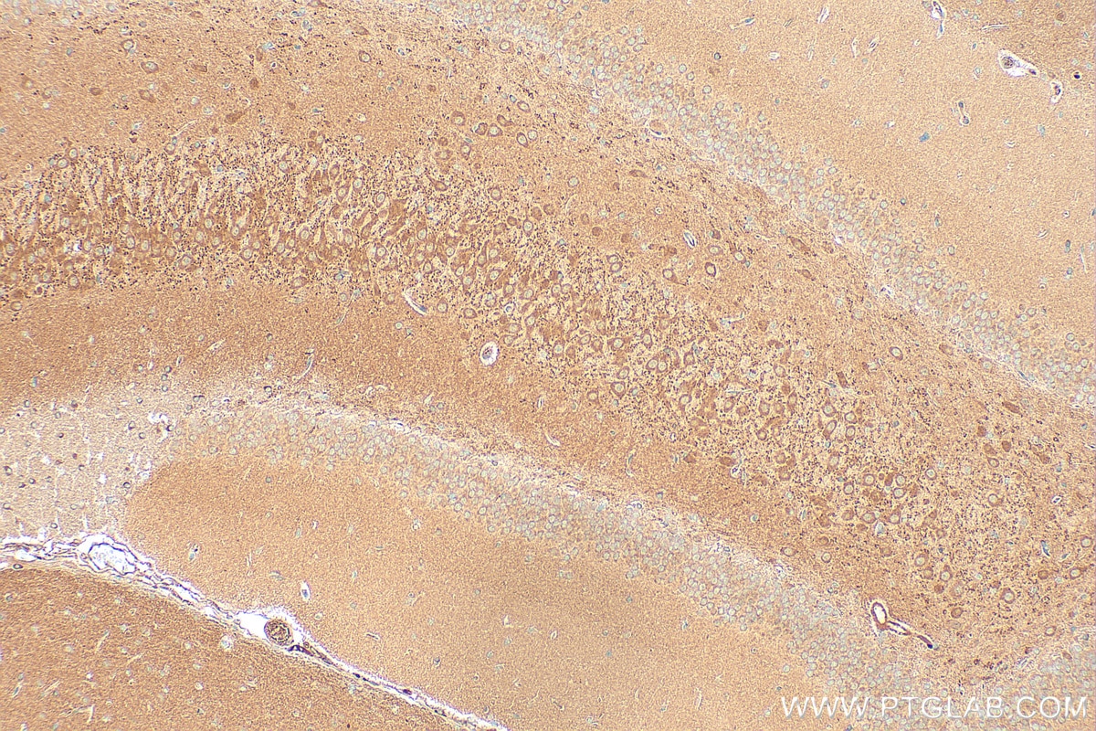 Immunohistochemical analysis of paraffin-embedded rat brain tissue slide using 16921-1-AP (ATL3 antibody) at dilution of 1:200 (under 10x lens). Heat mediated antigen retrieval with Tris-EDTA buffer (pH 9.0). Immunohistochemistry (IHC) staining of rat brain tissue using ATL3 Polyclonal antibody (16921-1-AP)