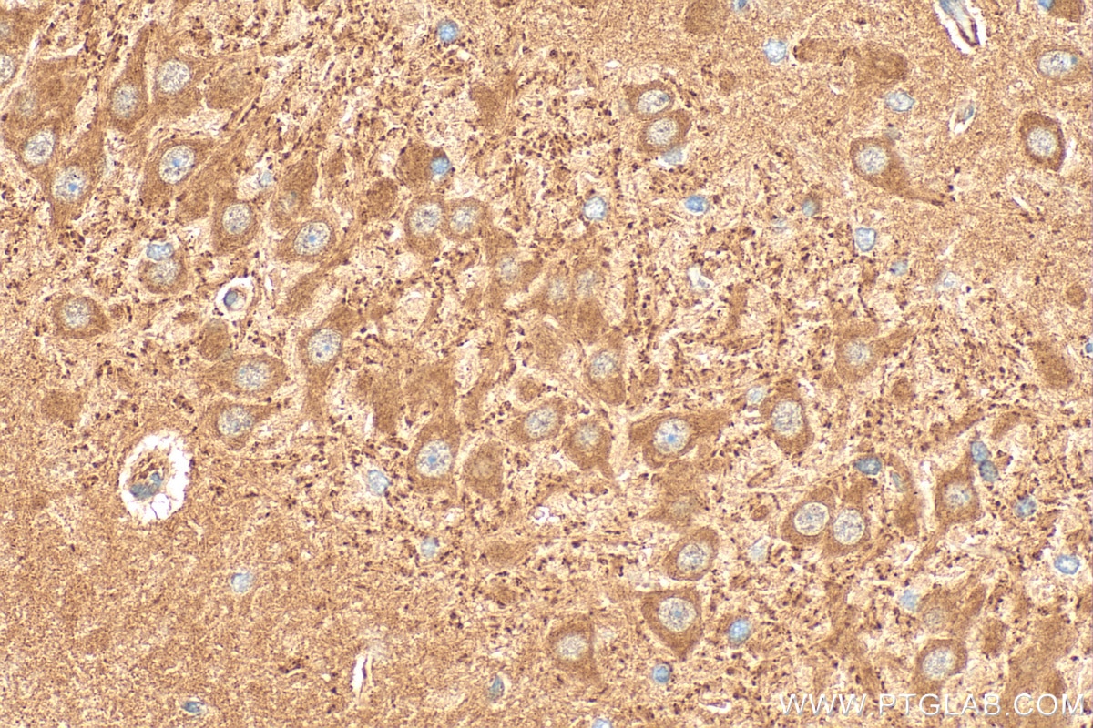 Immunohistochemical analysis of paraffin-embedded rat brain tissue slide using 16921-1-AP (ATL3 antibody) at dilution of 1:200 (under 40x lens). Heat mediated antigen retrieval with Tris-EDTA buffer (pH 9.0). Immunohistochemistry (IHC) staining of rat brain tissue using ATL3 Polyclonal antibody (16921-1-AP)