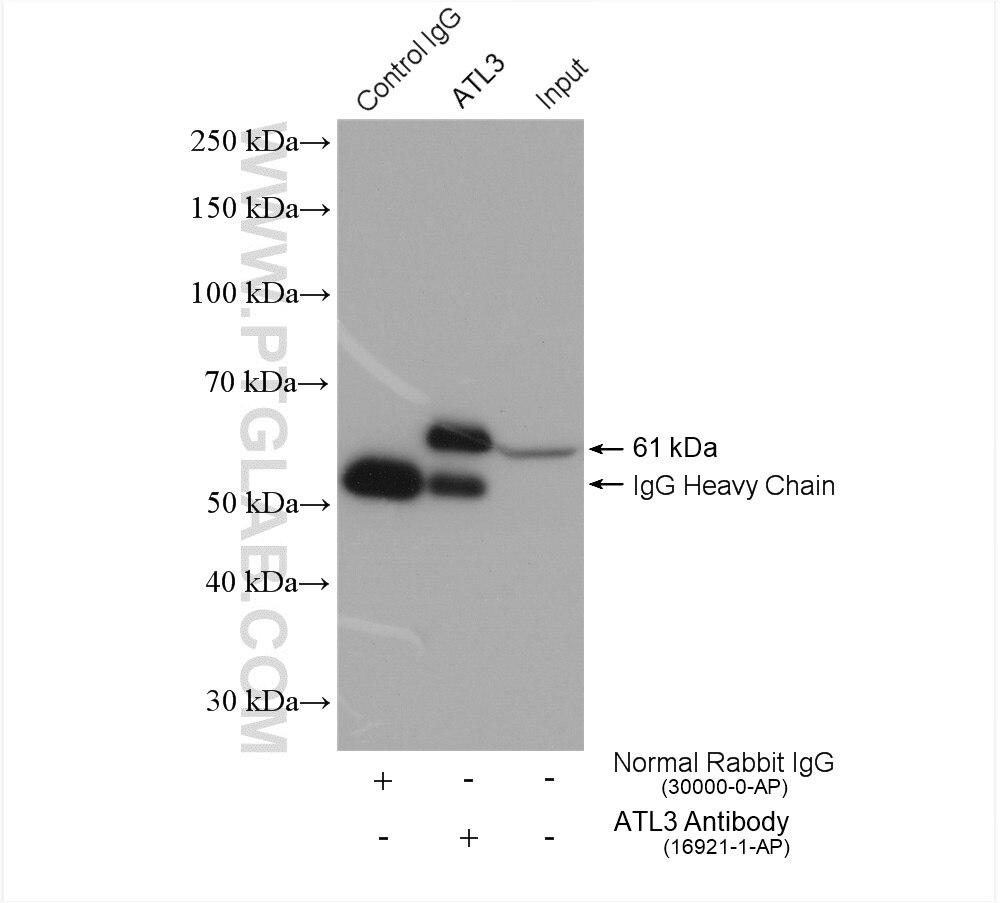 Immunoprecipitation (IP) experiment of HeLa cells using ATL3 Polyclonal antibody (16921-1-AP)