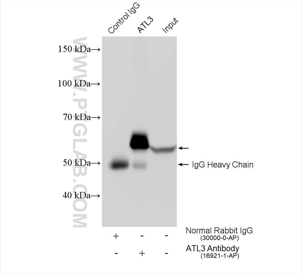 Immunoprecipitation (IP) experiment of HeLa cells using ATL3 Polyclonal antibody (16921-1-AP)