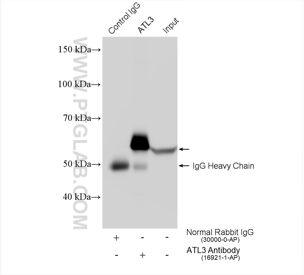 IP experiment of HeLa using 16921-1-AP