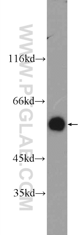 Western Blot (WB) analysis of HeLa cells using ATL3 Polyclonal antibody (16921-1-AP)