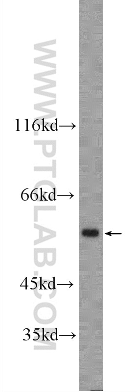Western Blot (WB) analysis of mouse liver tissue using ATL3 Polyclonal antibody (16921-1-AP)