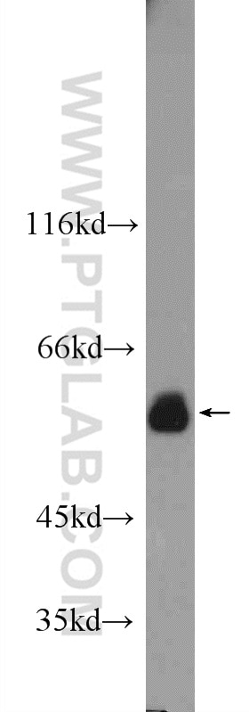 Western Blot (WB) analysis of HEK-293 cells using ATL3 Polyclonal antibody (16921-1-AP)