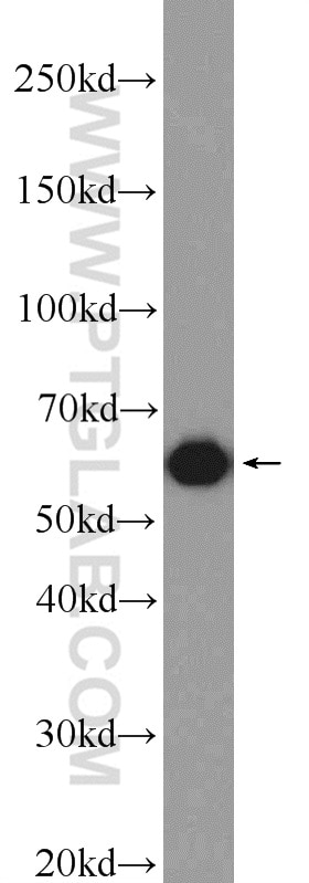 Western Blot (WB) analysis of SMMC-7721 cells using ATL3 Polyclonal antibody (16921-1-AP)