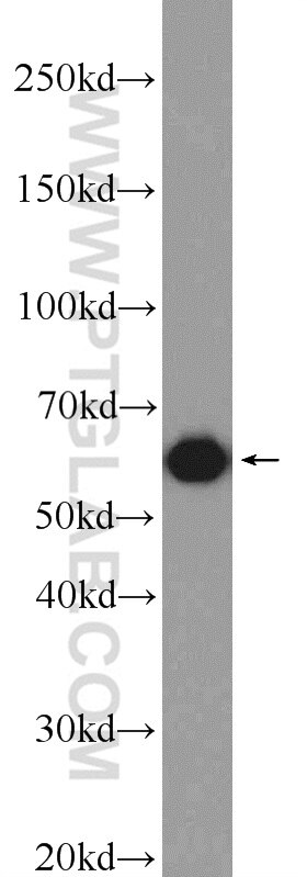 WB analysis of SMMC-7721 using 16921-1-AP