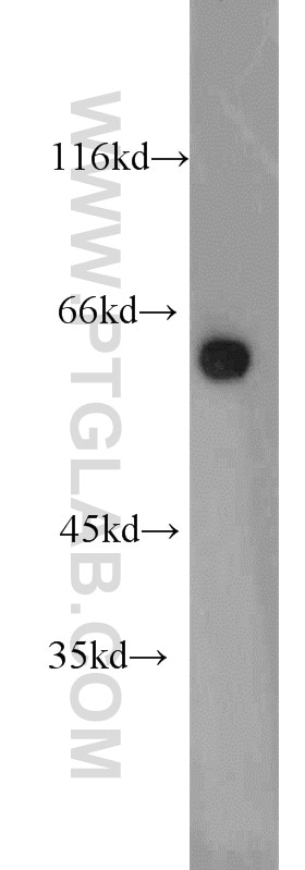 Western Blot (WB) analysis of HepG2 cells using ATL3 Polyclonal antibody (16921-1-AP)