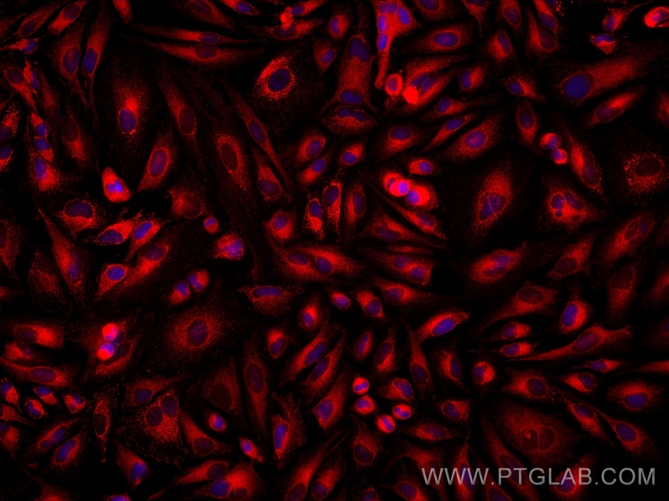 Immunofluorescence (IF) / fluorescent staining of HeLa cells using ATL3 Monoclonal antibody (68516-1-Ig)