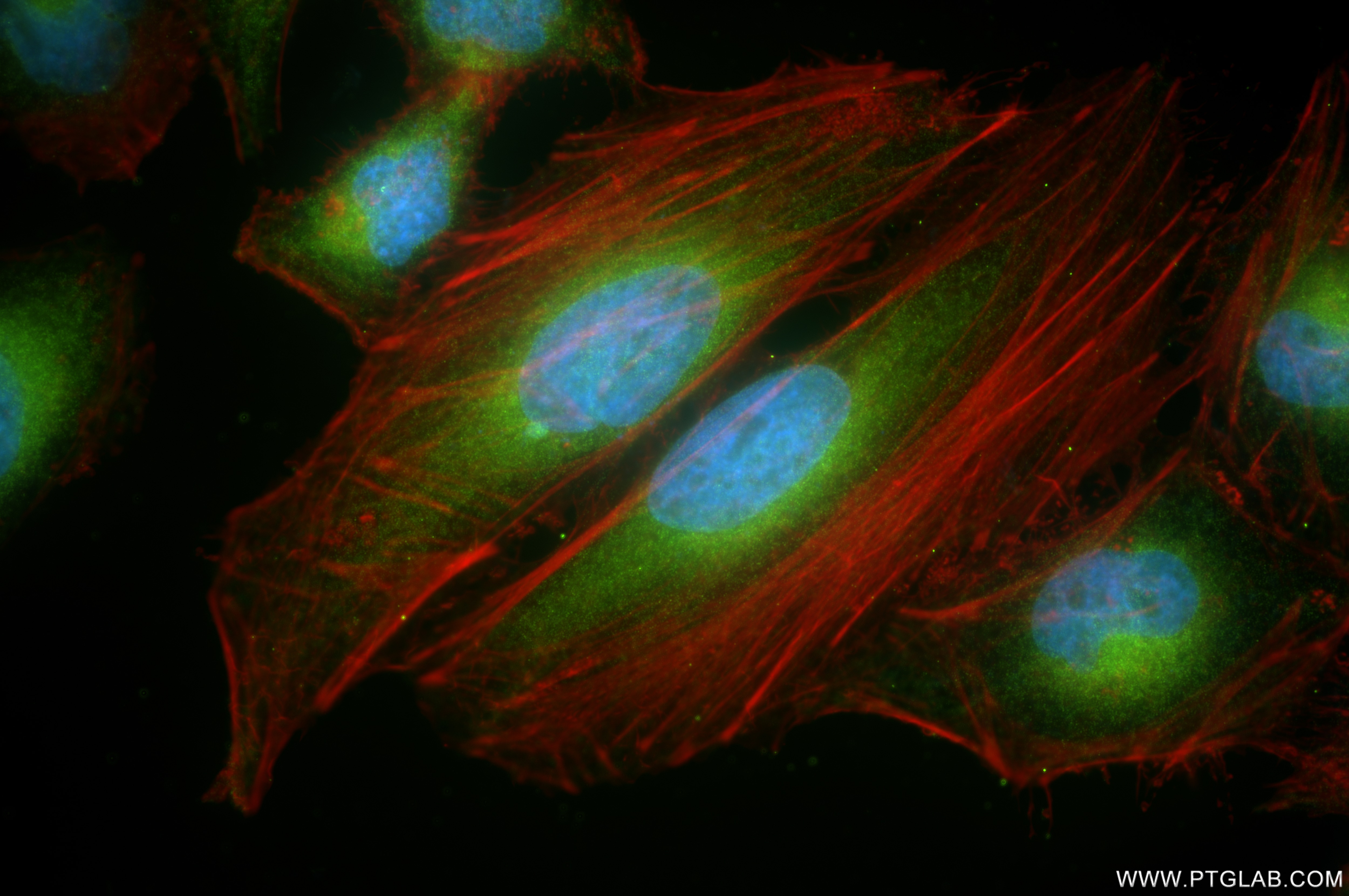 Immunofluorescence (IF) / fluorescent staining of HeLa cells using ATL3 Recombinant antibody (84578-3-RR)